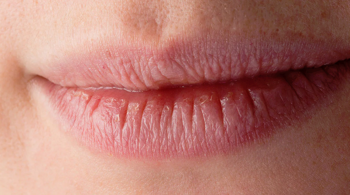 I migliori rimedi per labbra screpolate: guida ai prodotti più efficaci per l'autunno